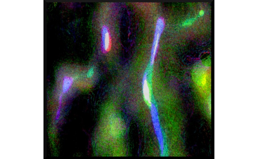 Illustration: photo of brain coral digitally manipulated to resemble the aurora borealis, or dancing abstract ghosts in the night